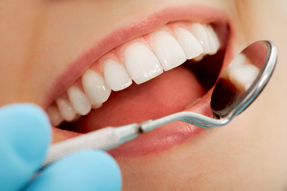 What Are the Most Popular Cosmetic Dentistry Treatments?